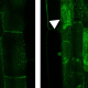 1_mycorrhiza_fluorescence